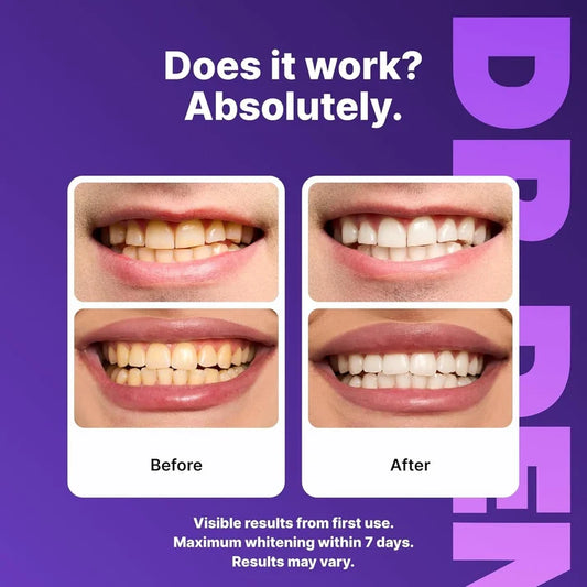 Teeth Whitening Strips
